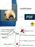 (2) Urolithiasis