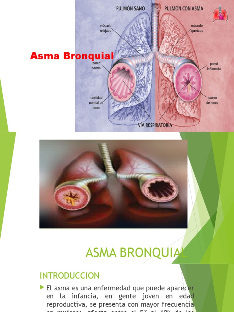 Asma Bronquial | PDF | Autosuperación | Bienestar