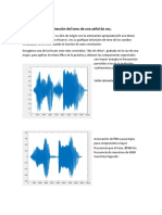 Detección Del Tono de Una Señal de Voz