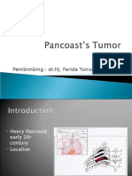 Pancoast’s Tumor.ppt