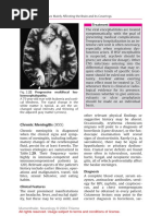 CSF Analysis and Meningitis Interpretation | PDF | Meningitis ...
