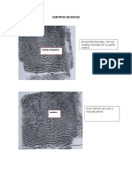 Subtipos de Arcos