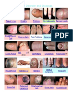 Nail Disorder and Diseases