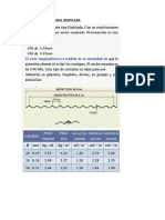 Calamina Galvanizada Ondulada