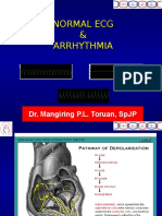 Normal Ecg & Arrhythmia