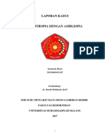 Lapsus Eksotropia Dengan Ambliopia