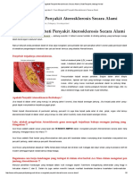 Cara Mengobati Penyakit Aterosklerosis Secara Alami - Obat Penyakit Jantung Herbal