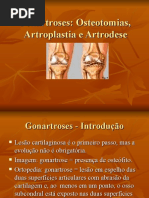 Gonartrose
