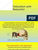 Disc Dislocation With Reduction Kel 6