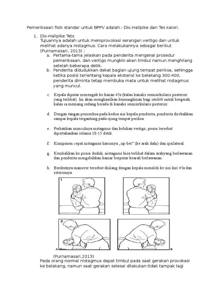 Pemeriksaan BPPV: Dix-Hallpike dan Kalori | PDF
