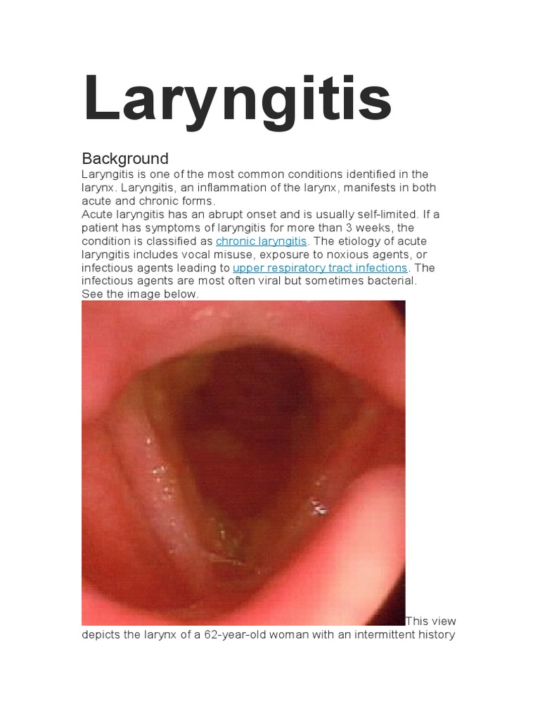 Laryngitis Common Cold Pneumonia