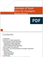 Tooth Preparation For Amalgam