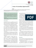 Liquorice: A Root Cause of Secondary Hypertension: Ravi Varma and Calum N. Ross