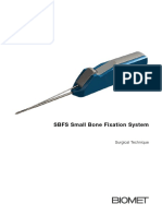 SBFS Small Bone Fixation System Surgical Technique