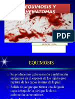 Equimosis y Hematomas