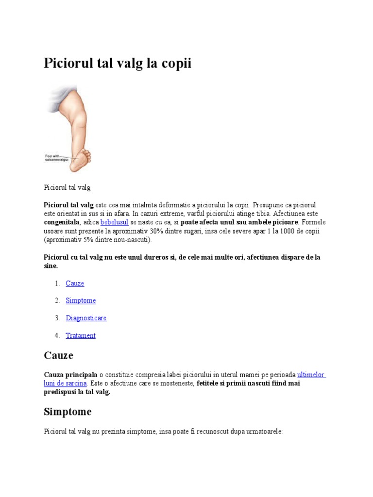 piciorul-tal-valg-la-copii-pdf