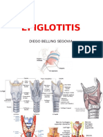 EPIGLOTITIS