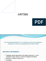 Aritmii