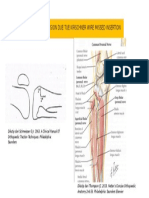 Peroneus Lession