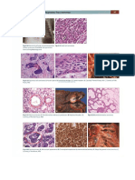 Extntals of Pathology - Pathoma