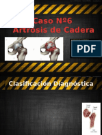 Caso No6 Artrosis Cadera