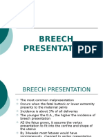 Breech Presentation 1
