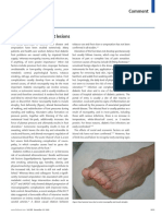 Causes of diabetic foot lesions and amputation