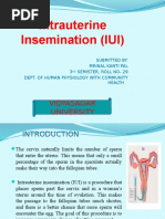 Intrauterine Insemination (IUI) : Vidyasagar University