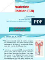 Intrauterine Insemination (IUI) : Vidyasagar University