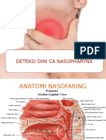 CA Nasofaring