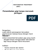 Penambalan Gigi Tanpa Merusak Jaringan: Atraumatic Restorative Treatment (ART)