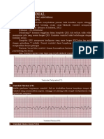 EKG ABNORMAL.docx