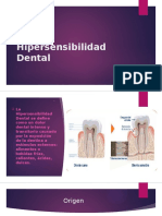 Hipersensibilidad Dental