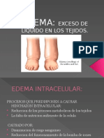 EDEMA