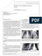 5-varon fumador.pdf