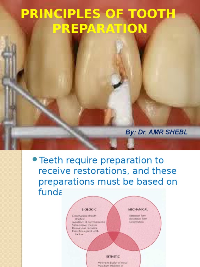 Principles of Tooth Preparation | PDF | Mouth | Dentistry