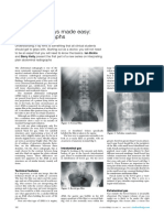 Abdominal X Rays Made Easy Normal Radiograph