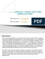 Hydrocephalus - Shunts and Third Venriculostomy