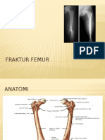 Fraktur Femur