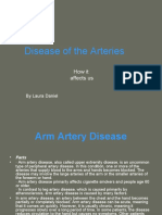 Disease of The Arteries: How It Affects Us