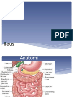 Ileus