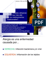 Alergia Tratamiento Más Allá de Los Medicamentos Tradicionales Merida