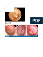 Otoscopy Images