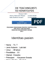 BST Pitted Keratolysis