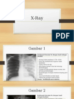 X-Ray Homework 1