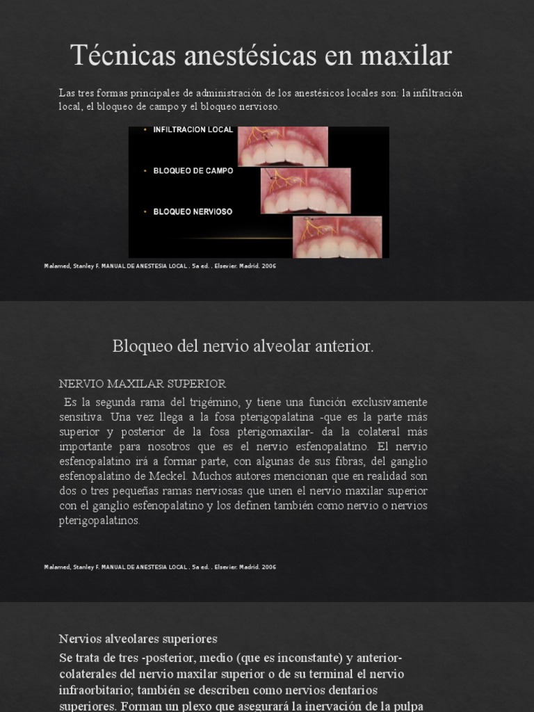 Técnicas de Anestesia en Maxilar | PDF | Boca | Anatomía de los primates