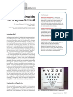 Disminución de la agudeza visual causas diagnóstico