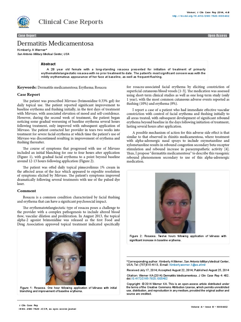 Clinical Case Reports: Dermatitis Medicamentosa | Download Free PDF ...