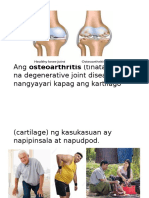 Osteoarthritis HANDOUT TAGALOG 