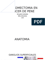 Indicaciones de Linfamectomia en Cancer de Pene